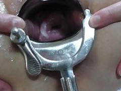 Sexually available mom gets a vaginal speculum deep in her twat hole